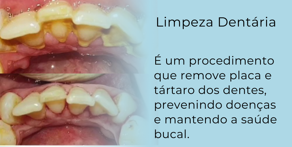 carrossel